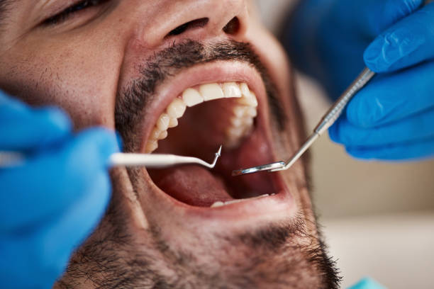 Best Oral Cancer Screening  in Petersburg, IN